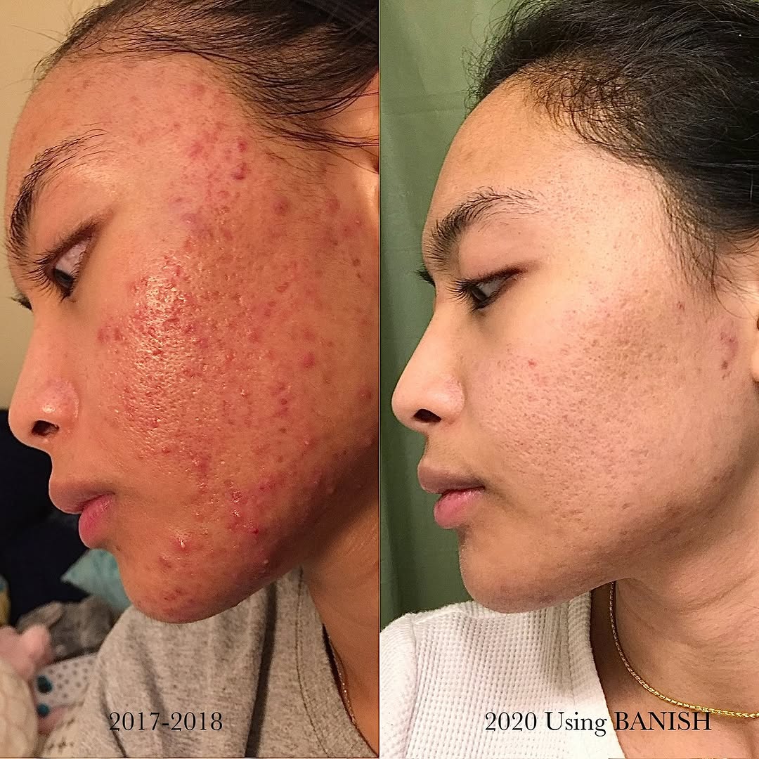 Banisher Head Trilogy - All Sizes for Banisher 3.0