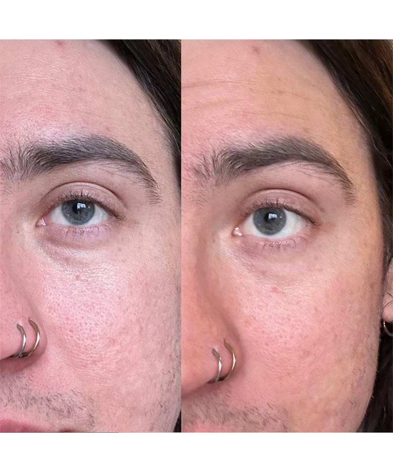 banish eye cream before and after