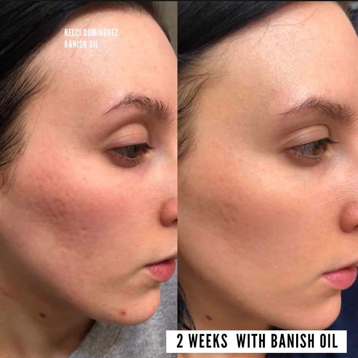 banish oil progress photo