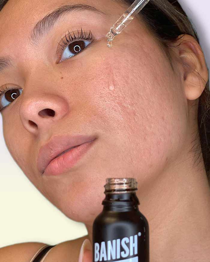 banish oil applied on skin